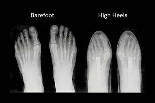 I’ve spent $20,000+ on shoes & 1000+ hours studying foot anatomy.