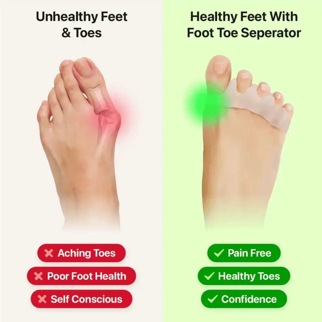 Oobend Foot Toe Separator